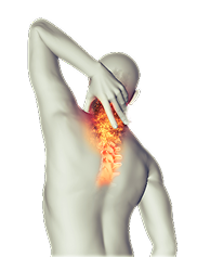 Neck Pain